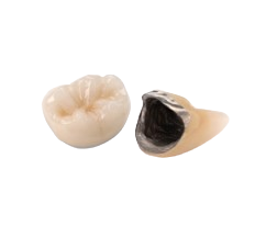 Prothèse conjointes